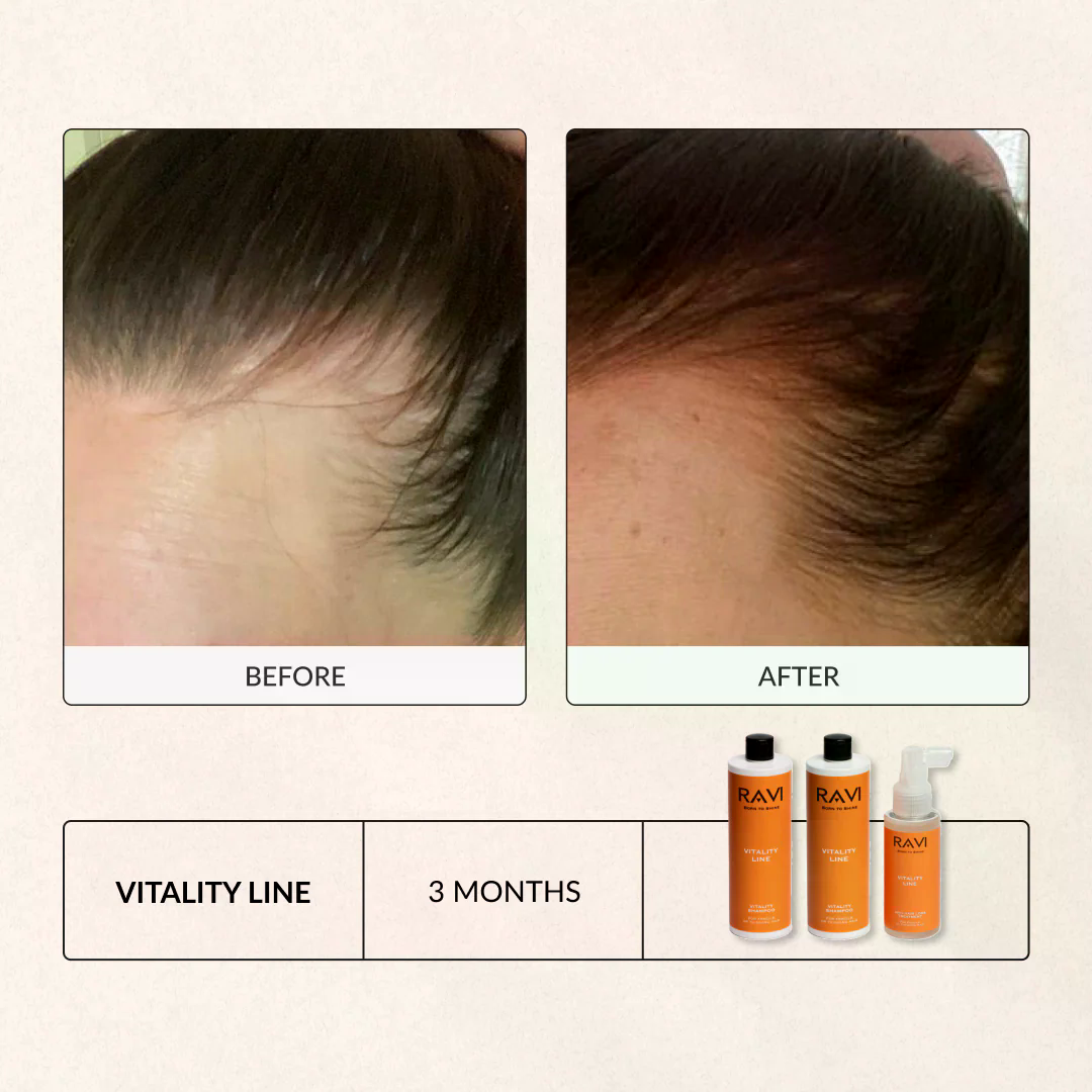 Vitality Line Shampoo