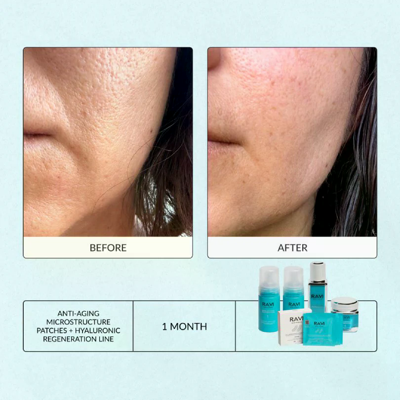 Hyaluronic Regeneration Day & Night Cream