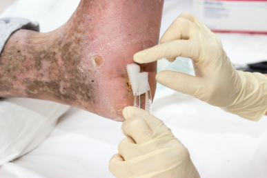 Zusatzqualifikation Wundtherapeut:in - Modul II