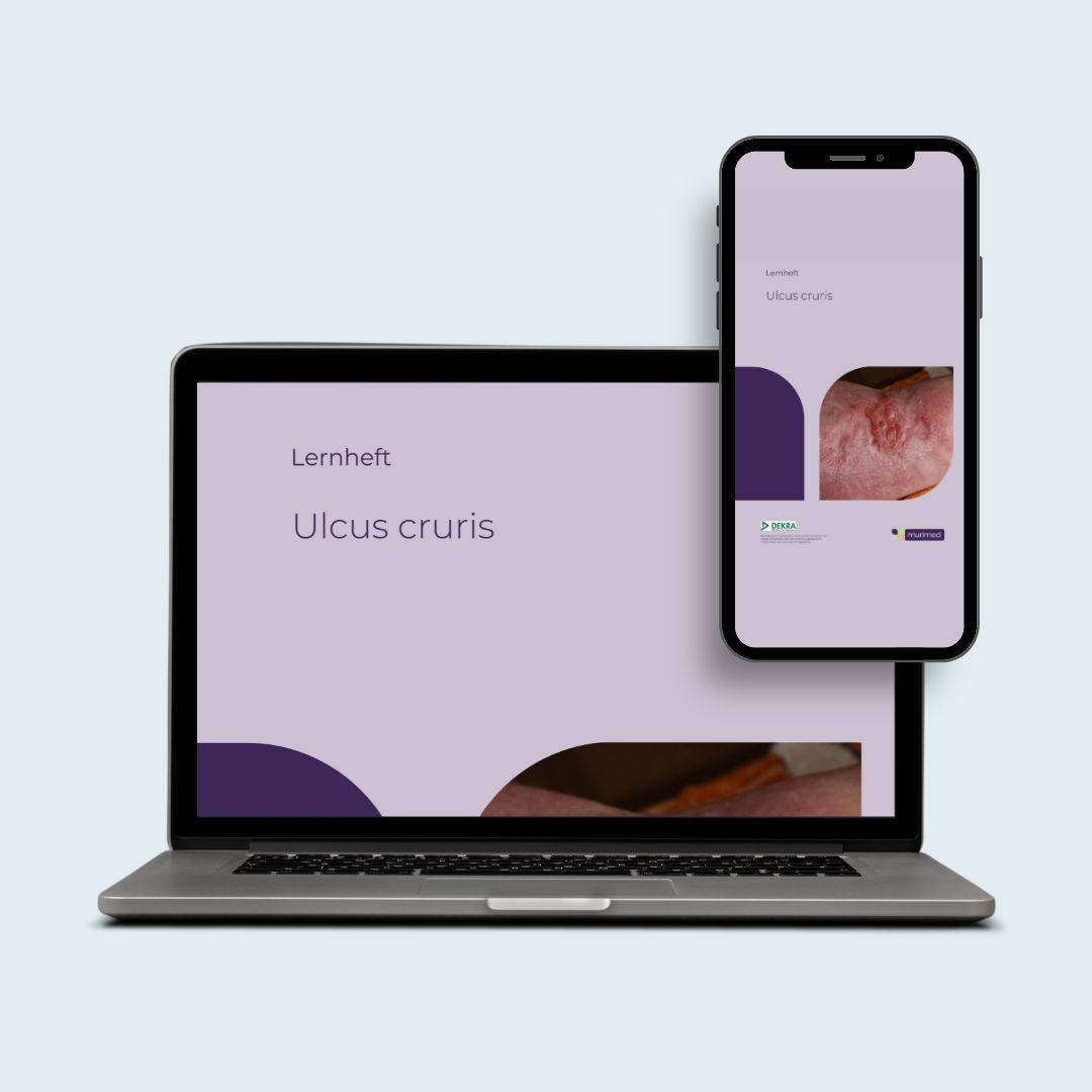 muriLearn FK 121 Ulcus cruris